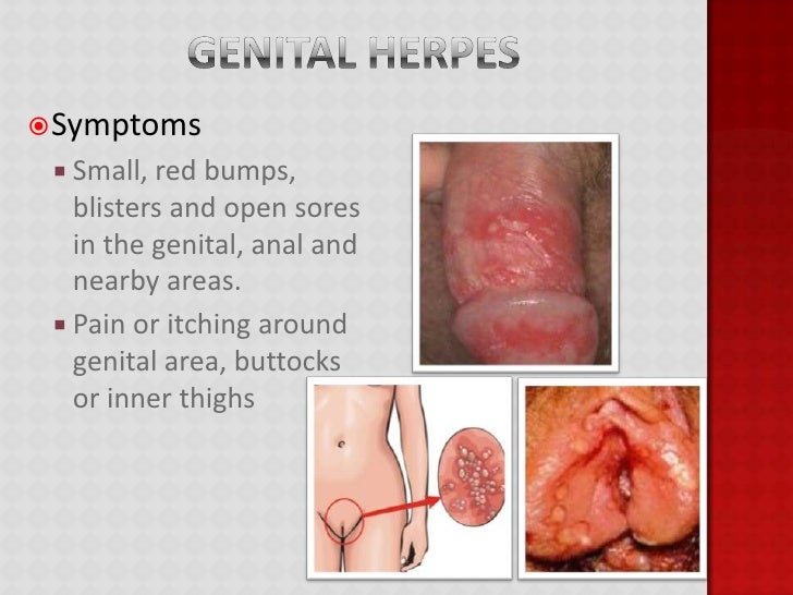 open sores around anus Asstr mom pussy licked